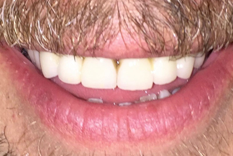 After