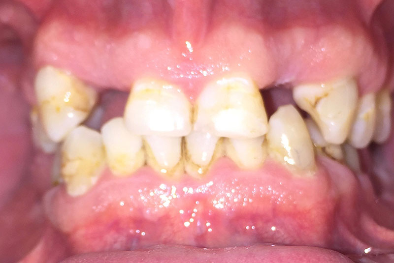 Before